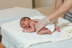 When Is a Birth Injury a Medical Malpractice Case?